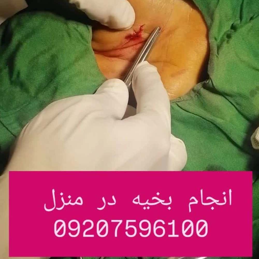 1771921795879.webp